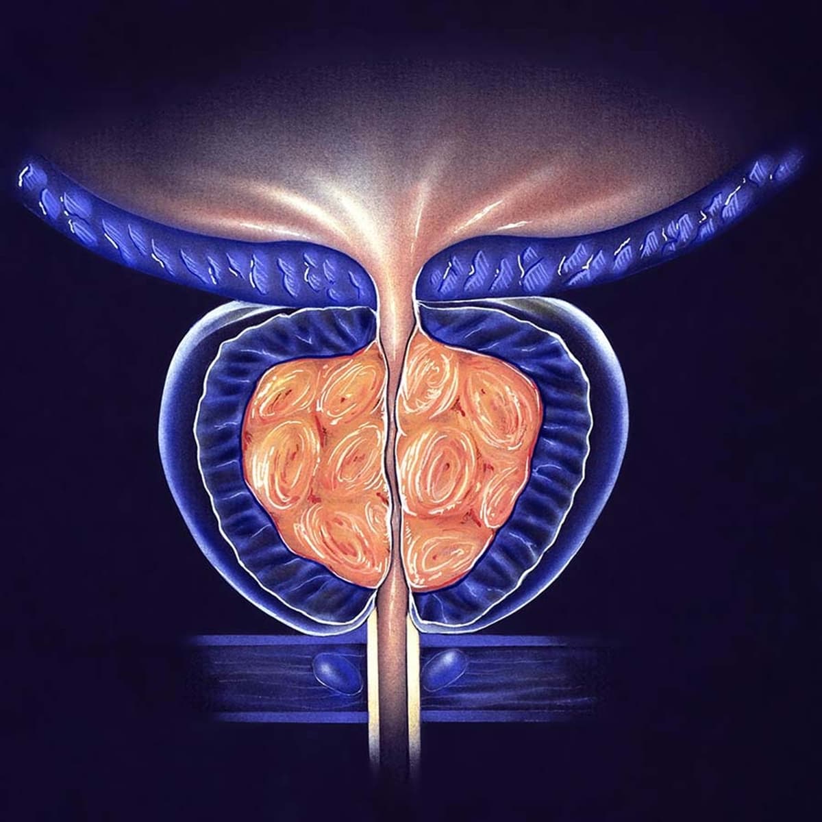 Prostate Cancer Symptoms