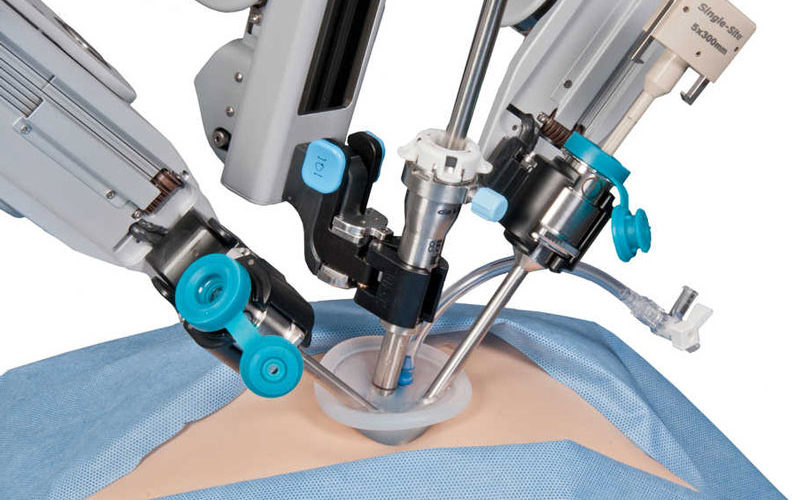 Роботизированное хирургическое лечение