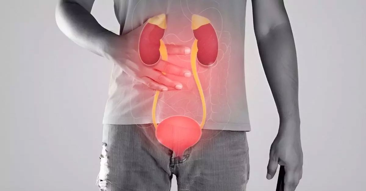 İdrar Yolu Enfeksiyonu Tedavisi 4 İdrar Yolu Enfeksiyonu Tedavisi