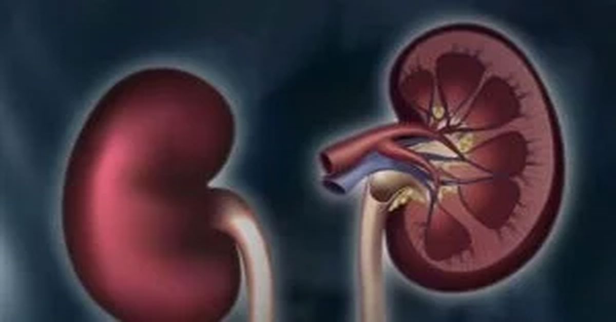 Kidney Cancer Surgery 3 Kidney Cancer Surgery