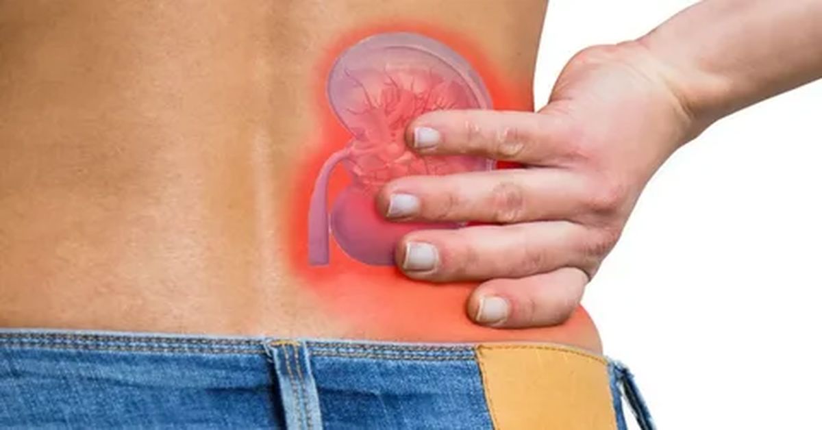 Böbrek Taşı Hastalığı