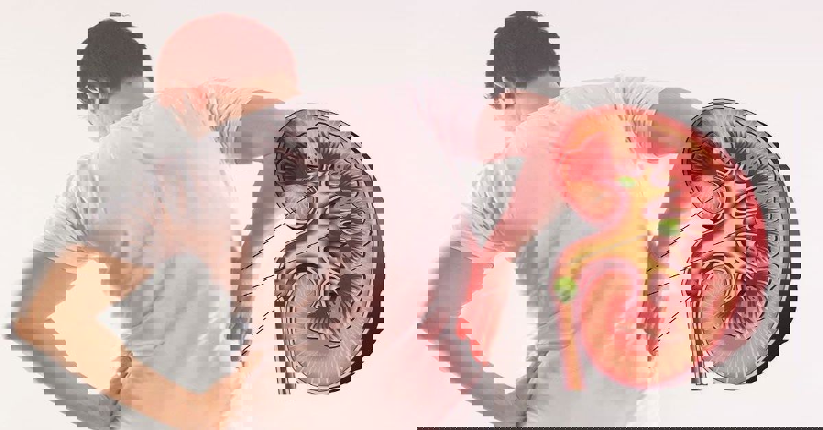 Böbrek Taşı Hastalığı 4 Böbrek Taşı Hastalığı