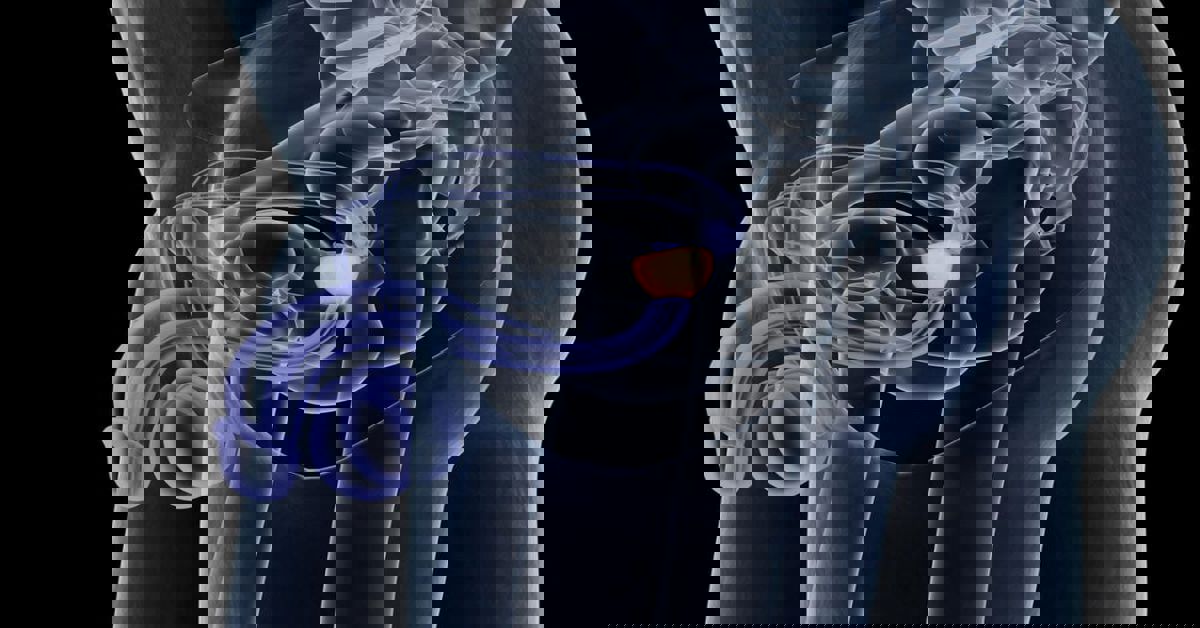 Prostat Enfeksiyonu 6 Prostate Infection