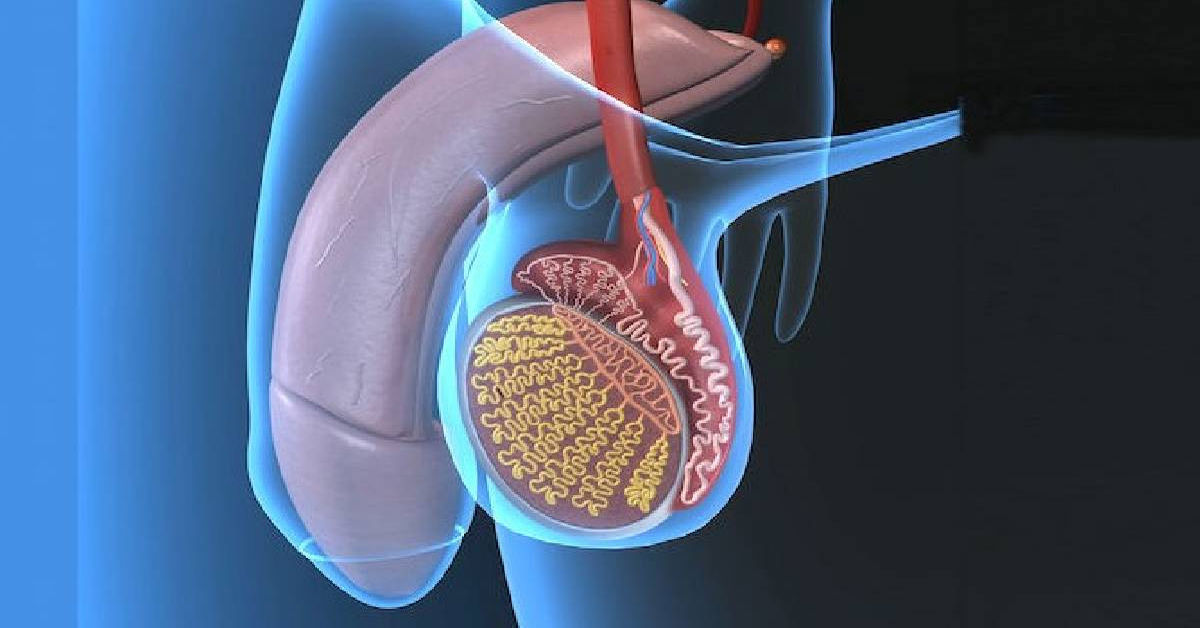Testis Torsiyonu 4 Testis Torsiyonu