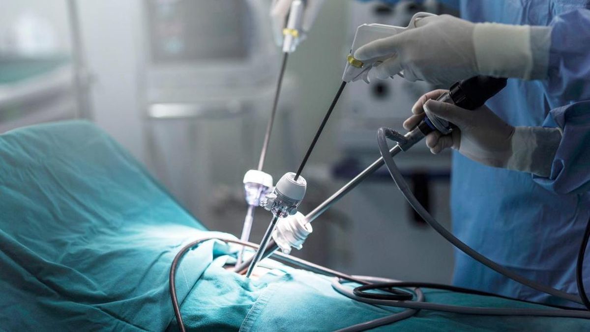 Laparoskopi Ameliyatı Nedir?