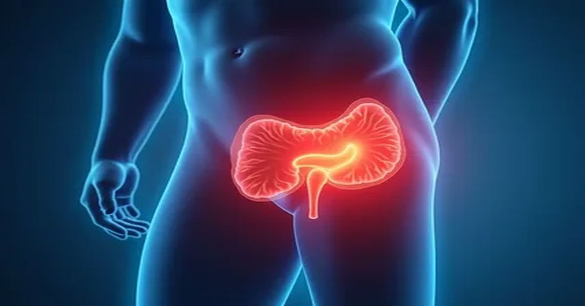 Prostat Kanseri Ameliyatı 4 Prostat Kanseri Ameliyatı