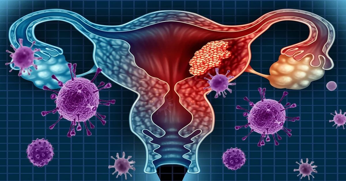 ThuLEP Yöntemi 4 ThuLEP Yöntemi